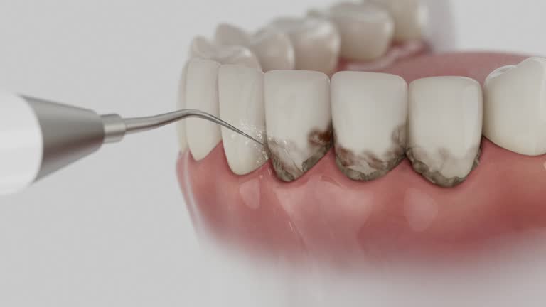 Reliable Tooth Extraction contractor in Scurry County County, TX by Dentist Open Now
